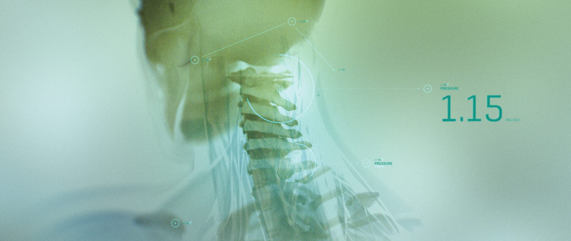 3D neck 02 (00000)